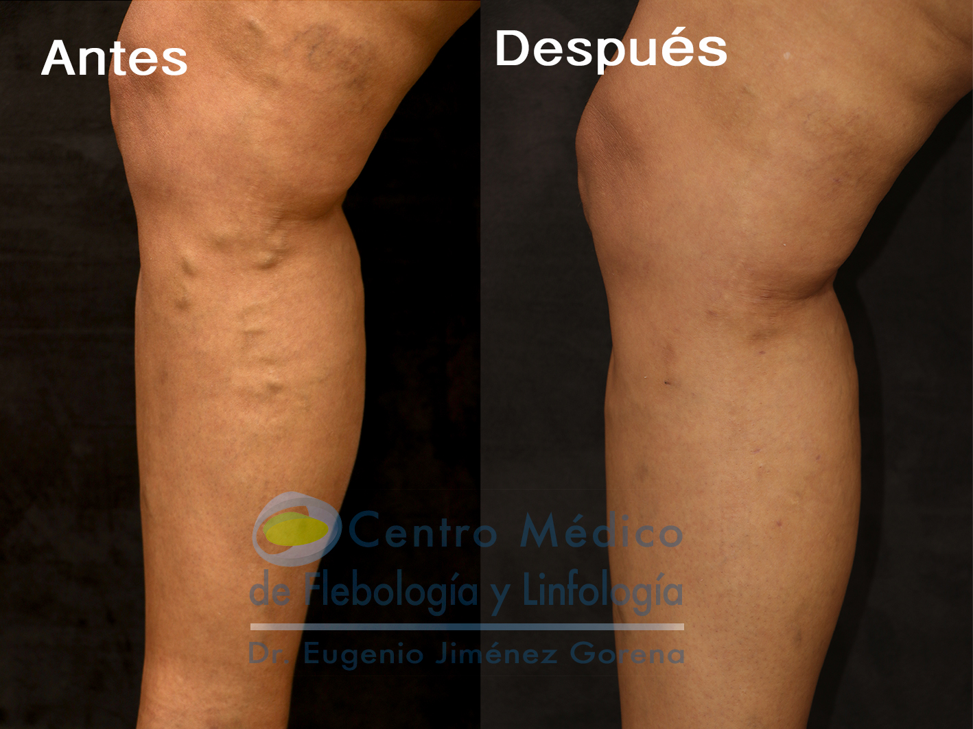 Antes y después de un paciente real